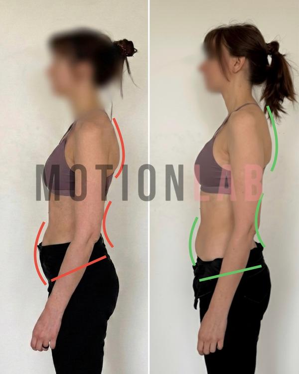 Коррекция осанки