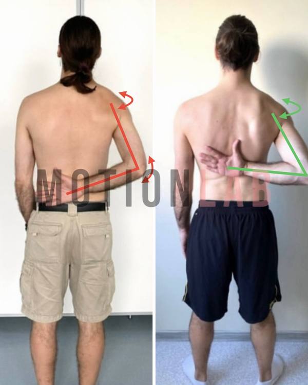 Подвижность плечевого сустава