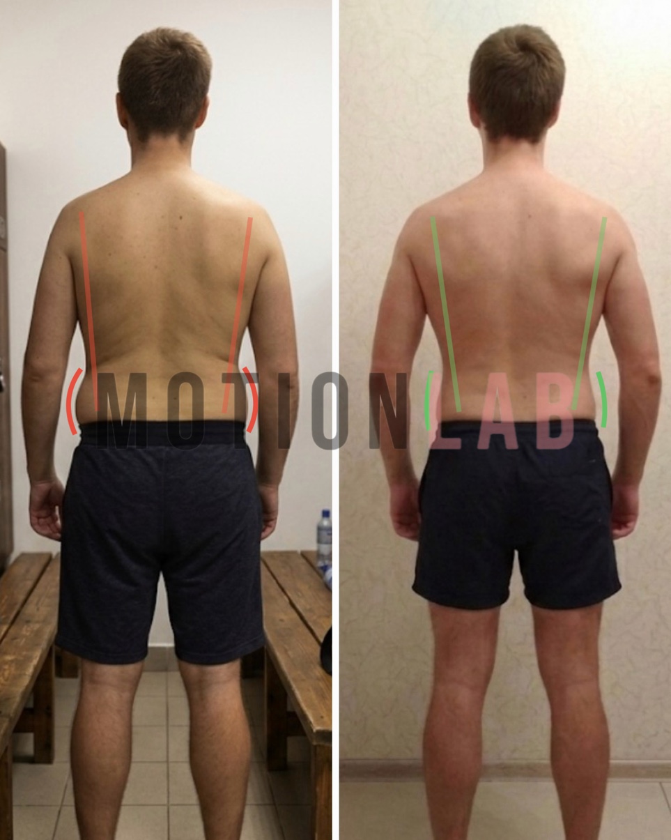 Асимметрия спины